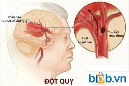 cach nhan biet va xu ly dot quy nhanh chong